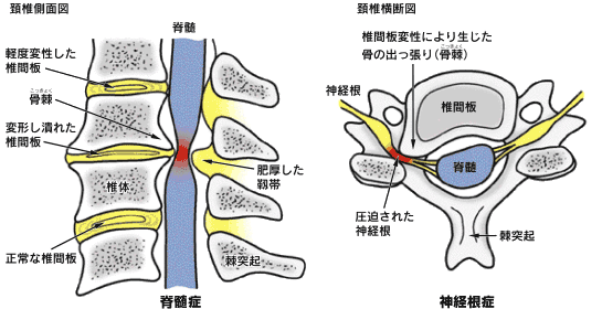 頸椎図